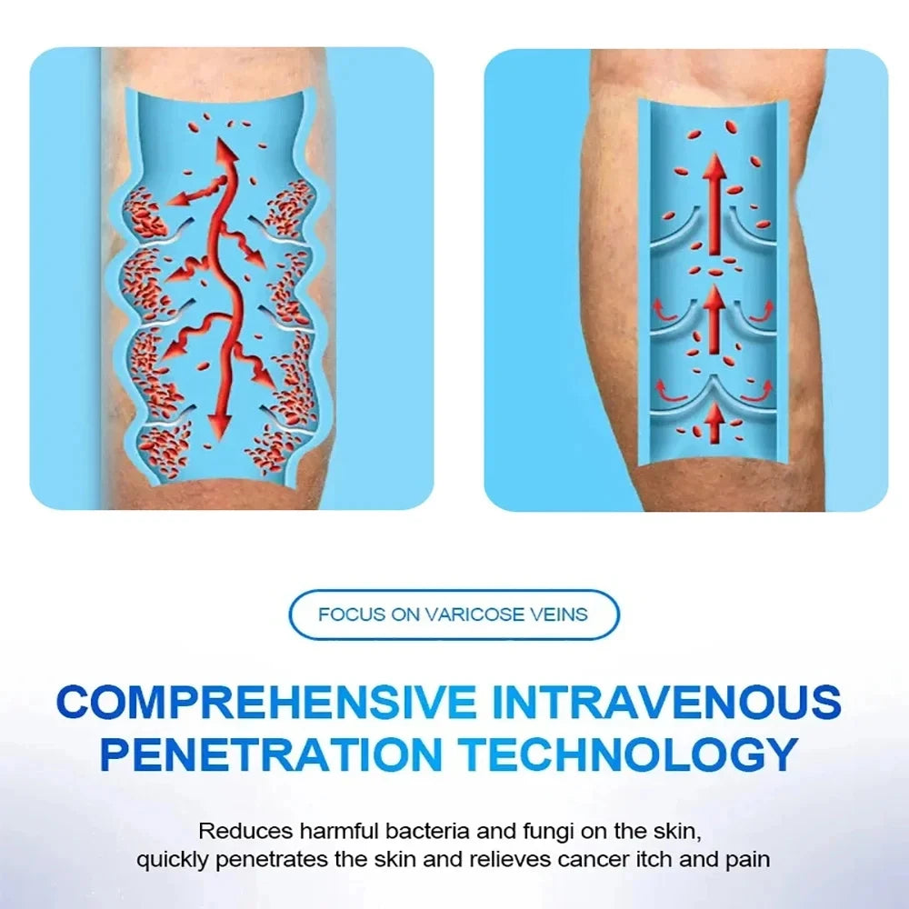 VeinEase™ – Precision Laser Therapy for Vein & Pain Relief