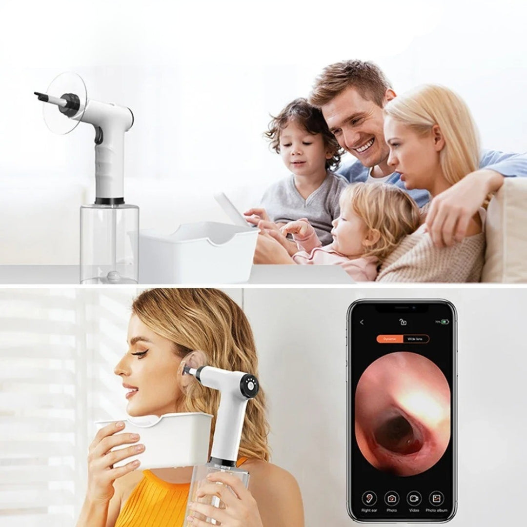 AuriClear™ - Ear Wax Remover