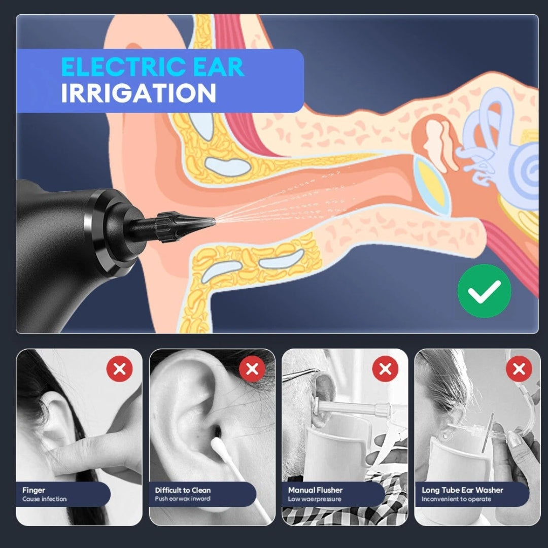 Sonique™ - Ear Wax Remover