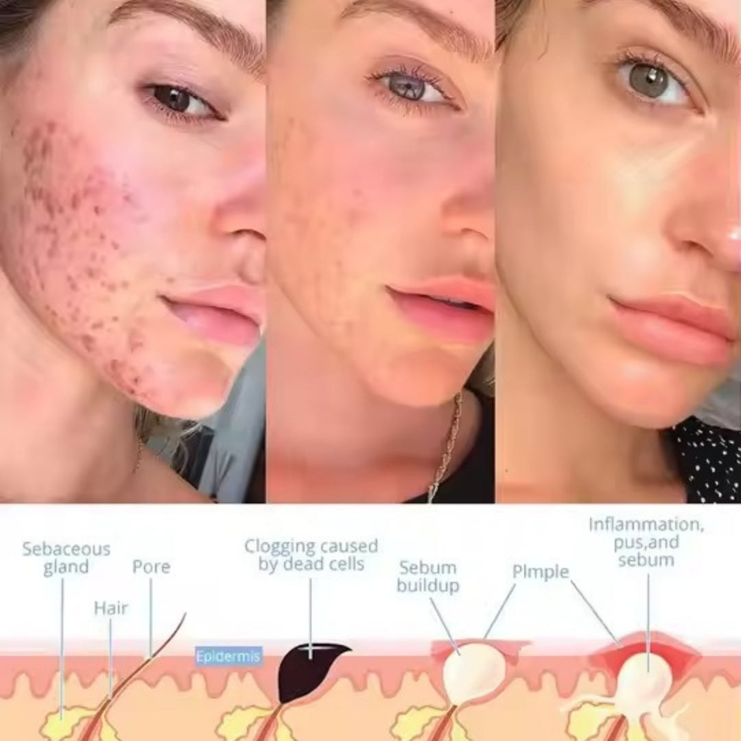 GlowPulse™ - Facial Wand