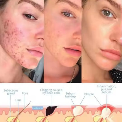 GlowPulse™ - Facial Wand